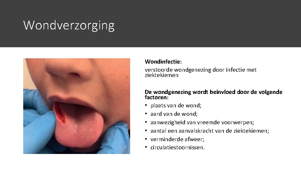 Wondverzorging Wondinfectie: verstoorde wondgenezing door infectie met ziektekiemen De wondgenezing wordt beïnvloed door de