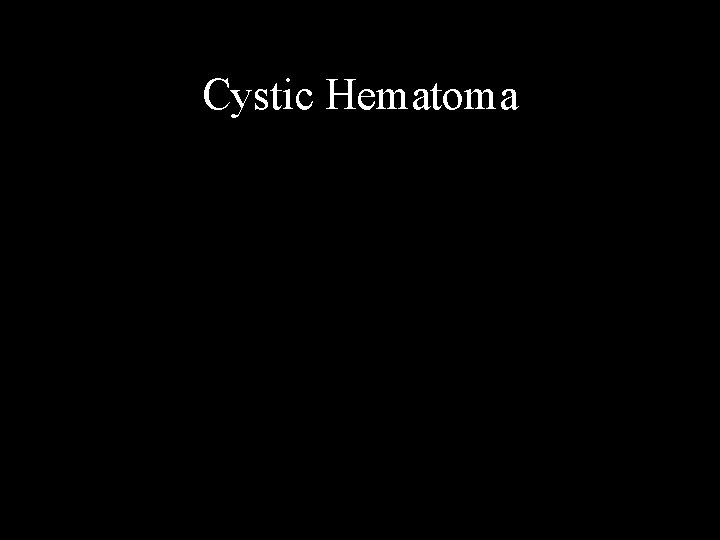 Cystic Hematoma 