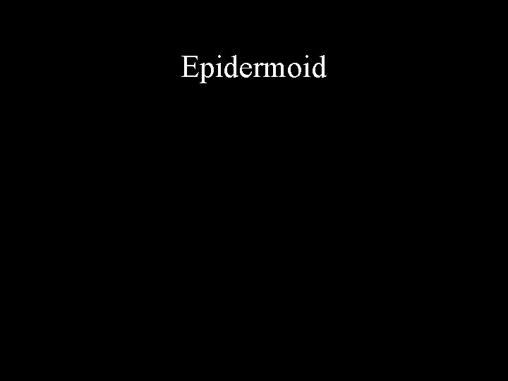 Epidermoid 