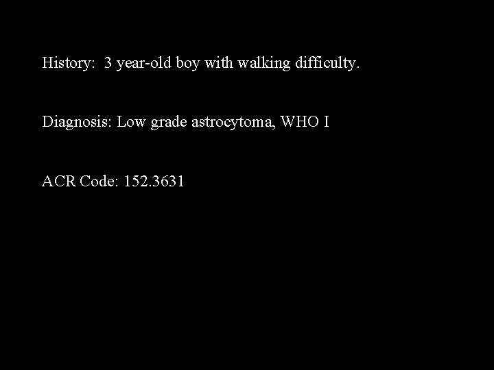 History: 3 year-old boy with walking difficulty. Diagnosis: Low grade astrocytoma, WHO I ACR