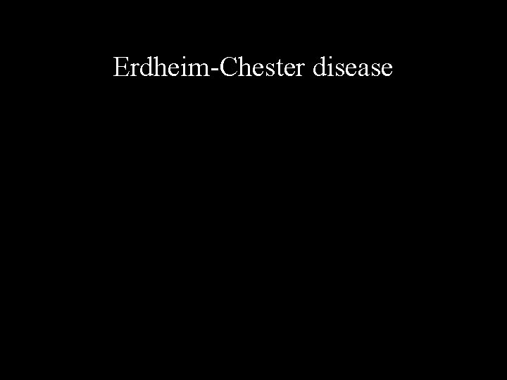 Erdheim-Chester disease 
