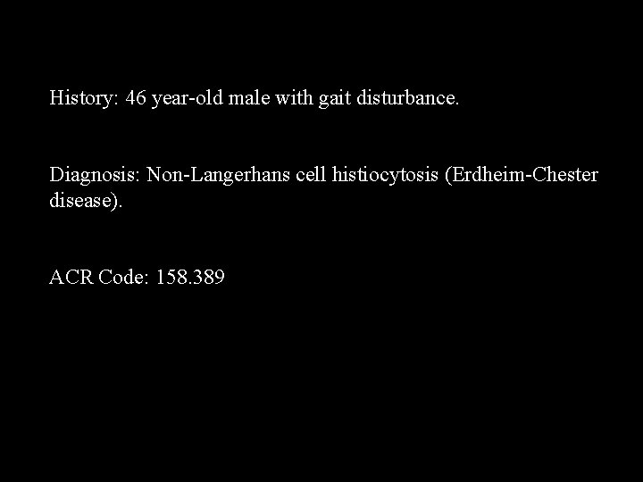 History: 46 year-old male with gait disturbance. Diagnosis: Non-Langerhans cell histiocytosis (Erdheim-Chester disease). ACR