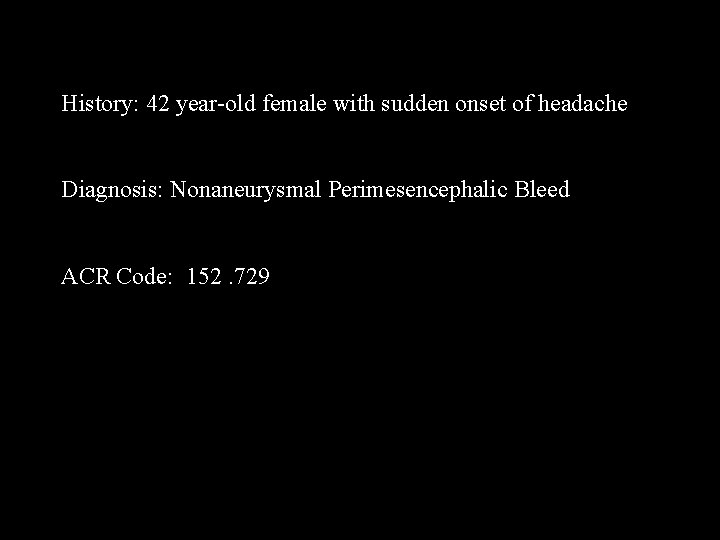 History: 42 year-old female with sudden onset of headache Diagnosis: Nonaneurysmal Perimesencephalic Bleed ACR