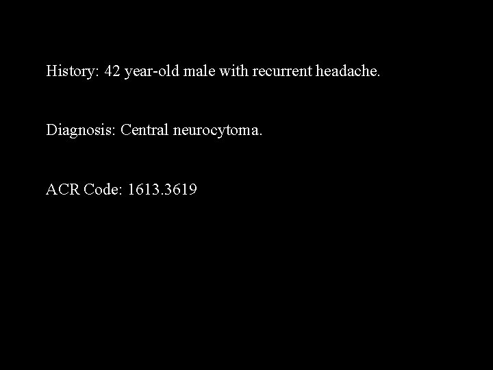 History: 42 year-old male with recurrent headache. Diagnosis: Central neurocytoma. ACR Code: 1613. 3619