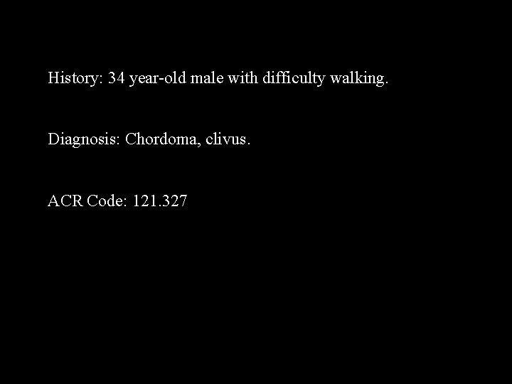 History: 34 year-old male with difficulty walking. Diagnosis: Chordoma, clivus. ACR Code: 121. 327