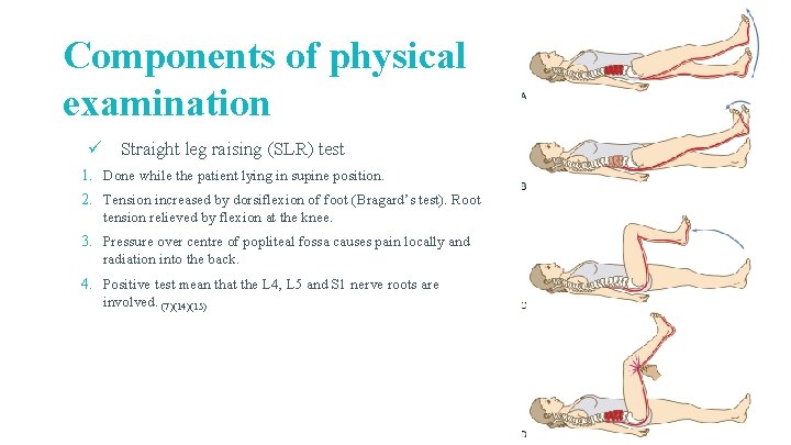 Components of physical examination ü Straight leg raising (SLR) test 1. Done while the