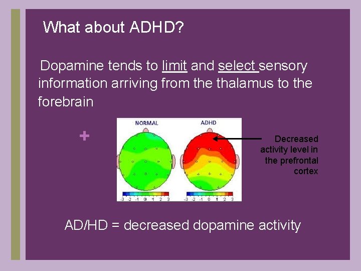 What about ADHD? Dopamine tends to limit and select sensory information arriving from the