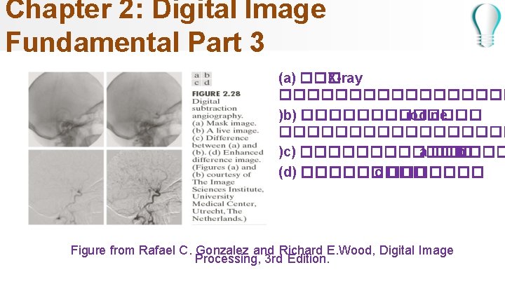 Chapter 2: Digital Image Fundamental Part 3 (a) ��� X-ray ��������� )b) ������� iodine