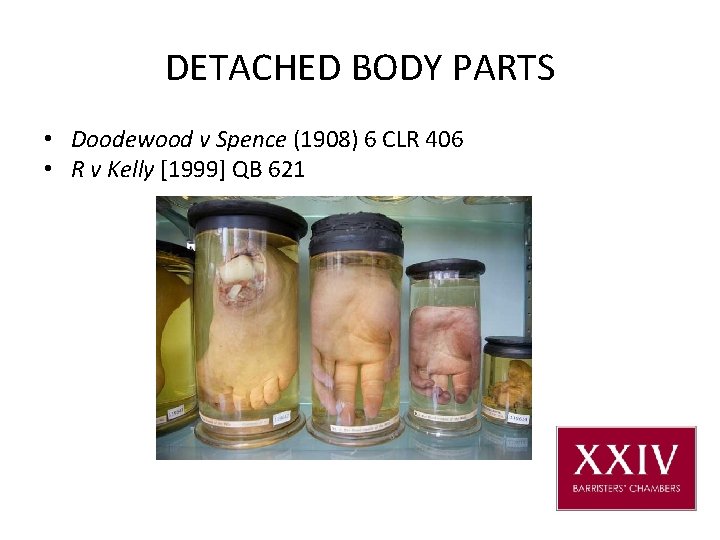 DETACHED BODY PARTS • Doodewood v Spence (1908) 6 CLR 406 • R v