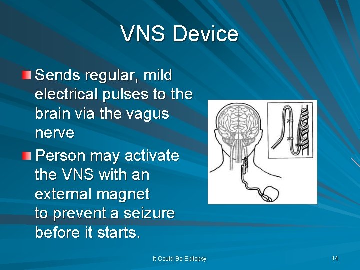 VNS Device Sends regular, mild electrical pulses to the brain via the vagus nerve