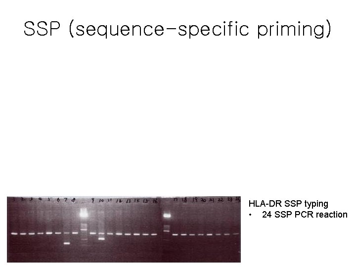 SSP (sequence-specific priming) HLA-DR SSP typing • 24 SSP PCR reaction 