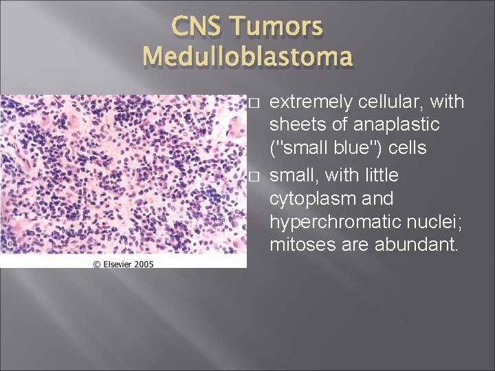 CNS Tumors Medulloblastoma � � extremely cellular, with sheets of anaplastic ("small blue") cells