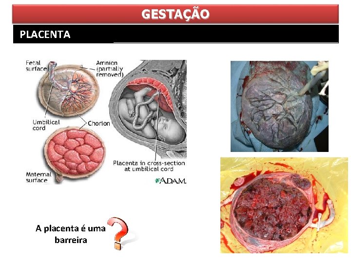 GESTAÇÃO PLACENTA A placenta é uma barreira 