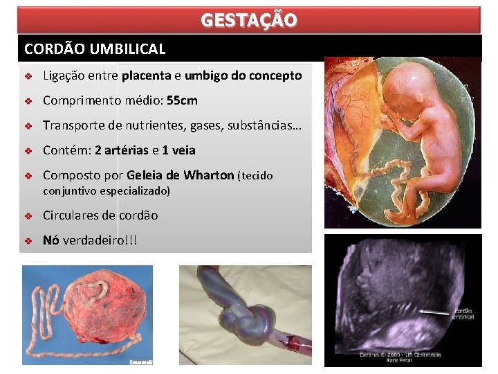 GESTAÇÃO CORDÃO UMBILICAL v Ligação entre placenta e umbigo do concepto v Comprimento médio: