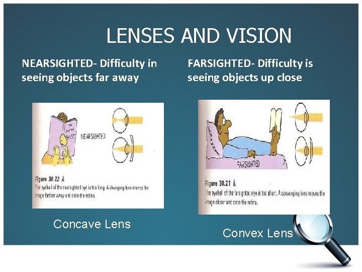 LENSES AND VISION NEARSIGHTED- Difficulty in seeing objects far away Concave Lens FARSIGHTED- Difficulty