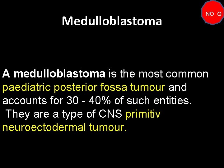 Medulloblastoma NO Q A medulloblastoma is the most common paediatric posterior fossa tumour and