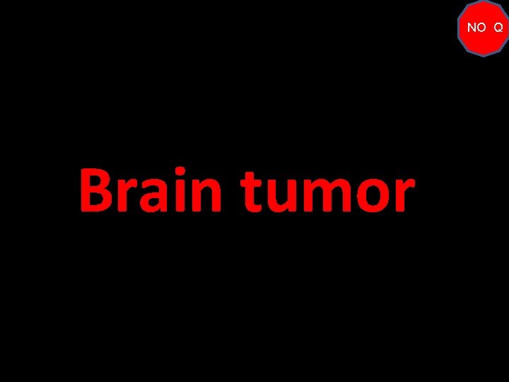 NO Q Brain tumor 