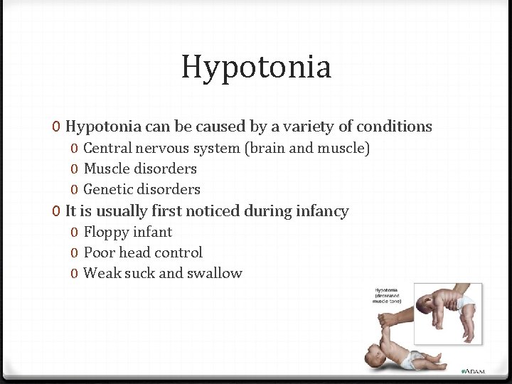 Hypotonia 0 Hypotonia can be caused by a variety of conditions 0 Central nervous