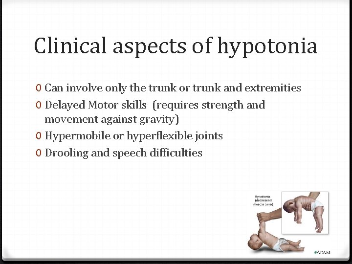 Clinical aspects of hypotonia 0 Can involve only the trunk or trunk and extremities