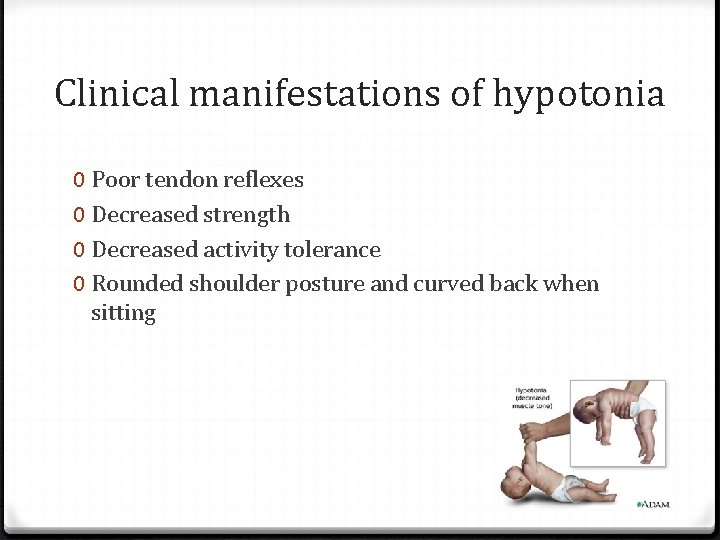 Clinical manifestations of hypotonia 0 Poor tendon reflexes 0 Decreased strength 0 Decreased activity