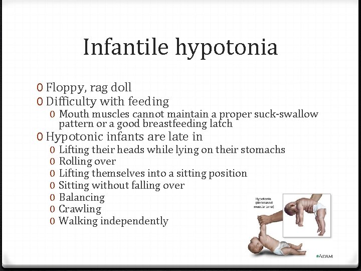 Infantile hypotonia 0 Floppy, rag doll 0 Difficulty with feeding 0 Mouth muscles cannot