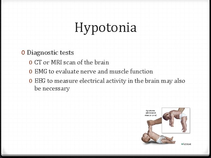 Hypotonia 0 Diagnostic tests 0 CT or MRI scan of the brain 0 EMG