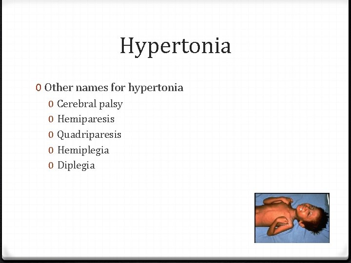 Hypertonia 0 Other names for hypertonia 0 0 0 Cerebral palsy Hemiparesis Quadriparesis Hemiplegia