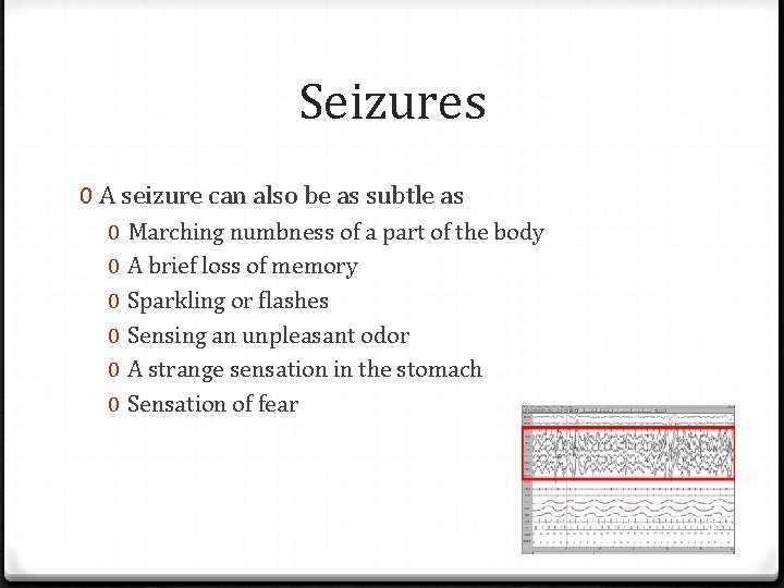 Seizures 0 A seizure can also be as subtle as 0 0 0 Marching
