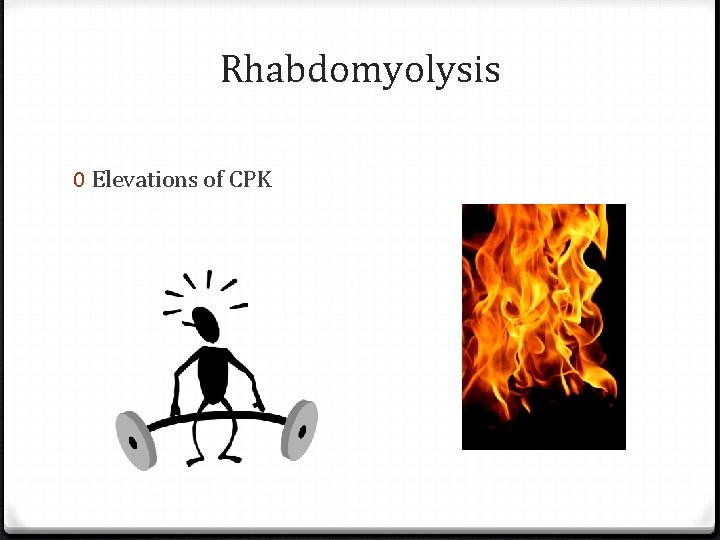 Rhabdomyolysis 0 Elevations of CPK 