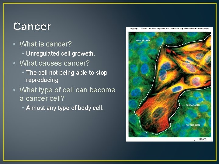 Cancer • What is cancer? • Unregulated cell groweth. • What causes cancer? •