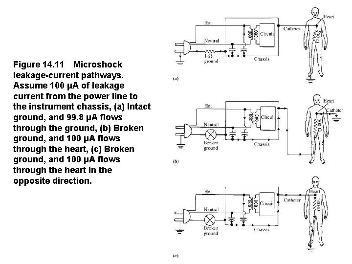 Figure 14. 11 Microshock leakage-current pathways.   Assume 100 μA of leakage current from the