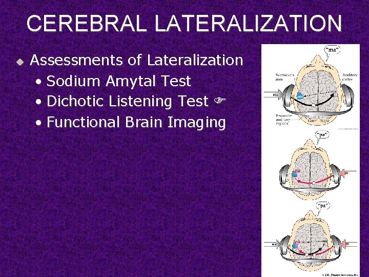 CEREBRAL LATERALIZATION u Assessments of Lateralization • Sodium Amytal Test • Dichotic Listening Test