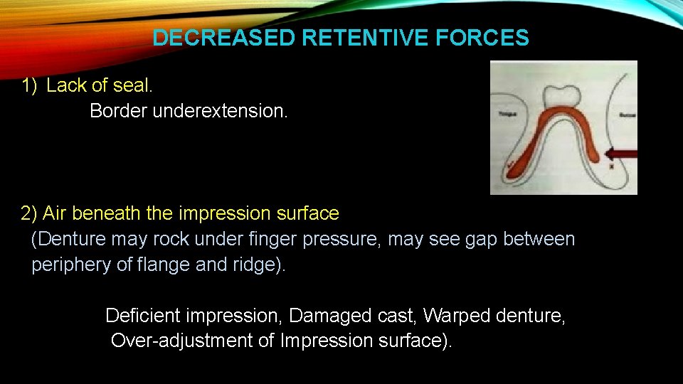 DECREASED RETENTIVE FORCES 1) Lack of seal. Border underextension. 2) Air beneath the impression