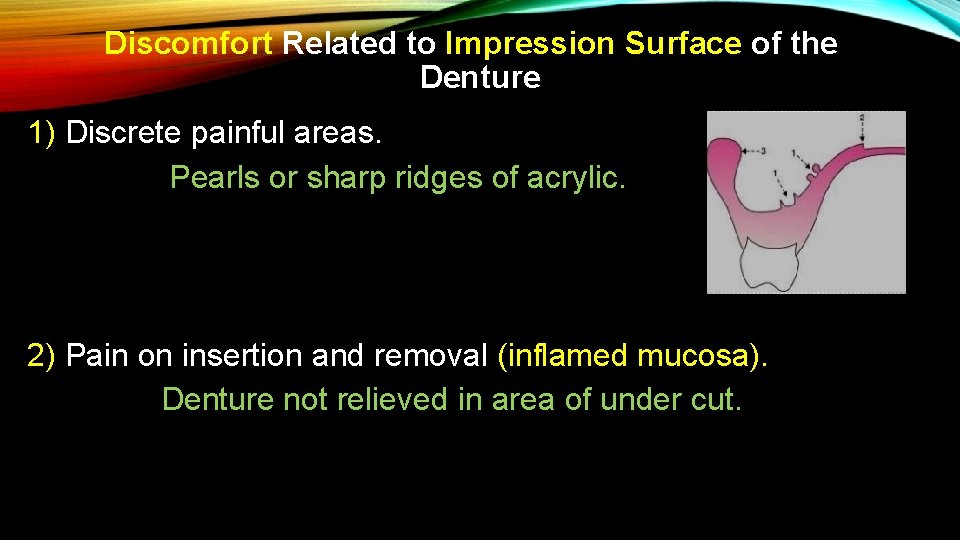 Discomfort Related to Impression Surface of the Denture 1) Discrete painful areas. Pearls or