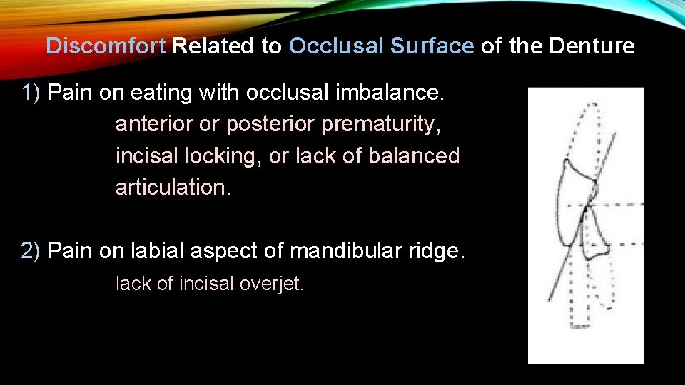 Discomfort Related to Occlusal Surface of the Denture 1) Pain on eating with occlusal