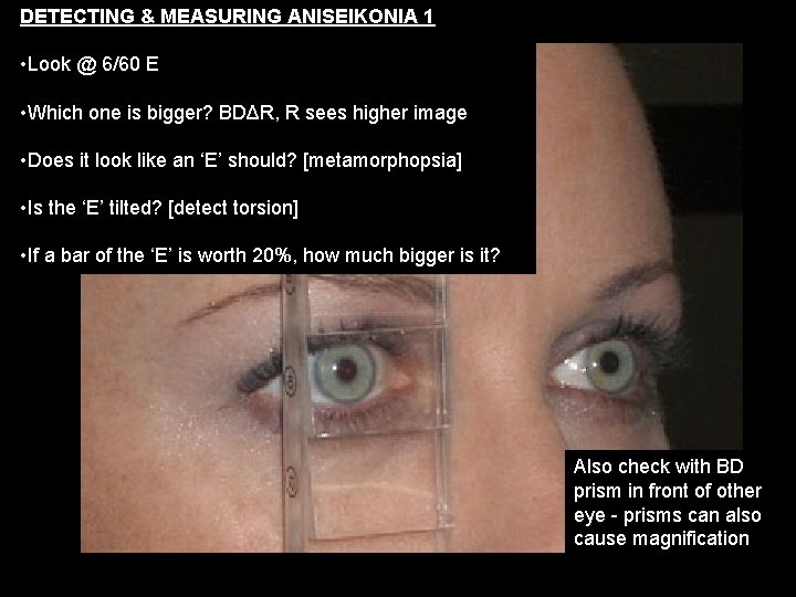 DETECTING & MEASURING ANISEIKONIA 1 • Look @ 6/60 E • Which one is