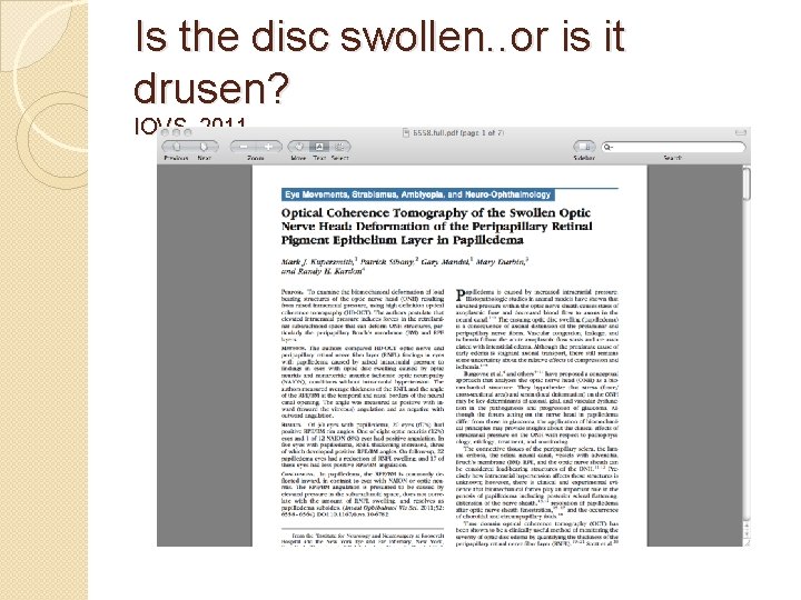 Is the disc swollen. . or is it drusen? IOVS 2011 