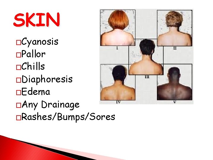 SKIN �Cyanosis �Pallor �Chills �Diaphoresis �Edema �Any Drainage �Rashes/Bumps/Sores 