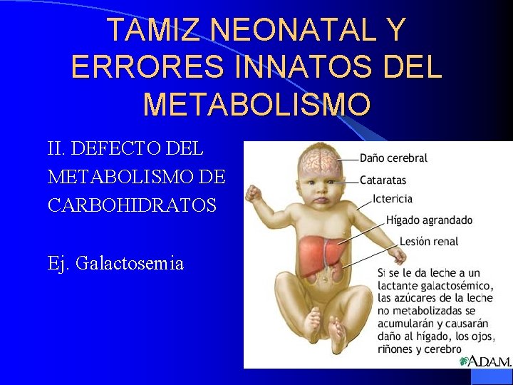 TAMIZ NEONATAL Y ERRORES INNATOS DEL METABOLISMO II. DEFECTO DEL METABOLISMO DE CARBOHIDRATOS Ej.