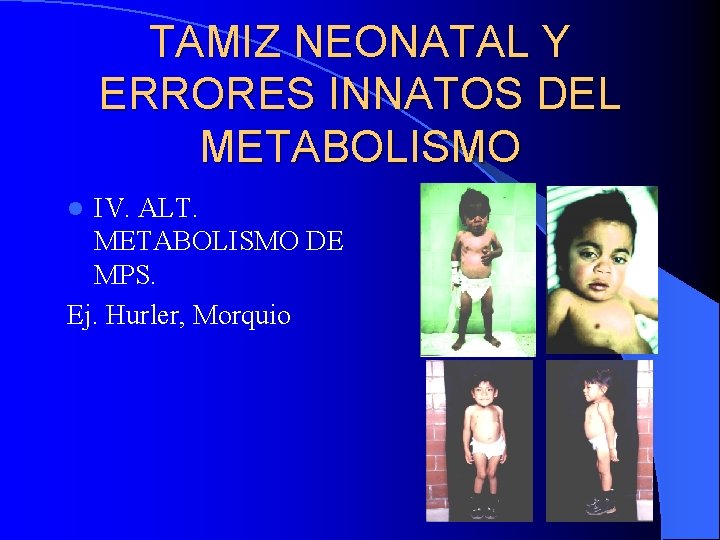 TAMIZ NEONATAL Y ERRORES INNATOS DEL METABOLISMO IV. ALT. METABOLISMO DE MPS. Ej. Hurler,
