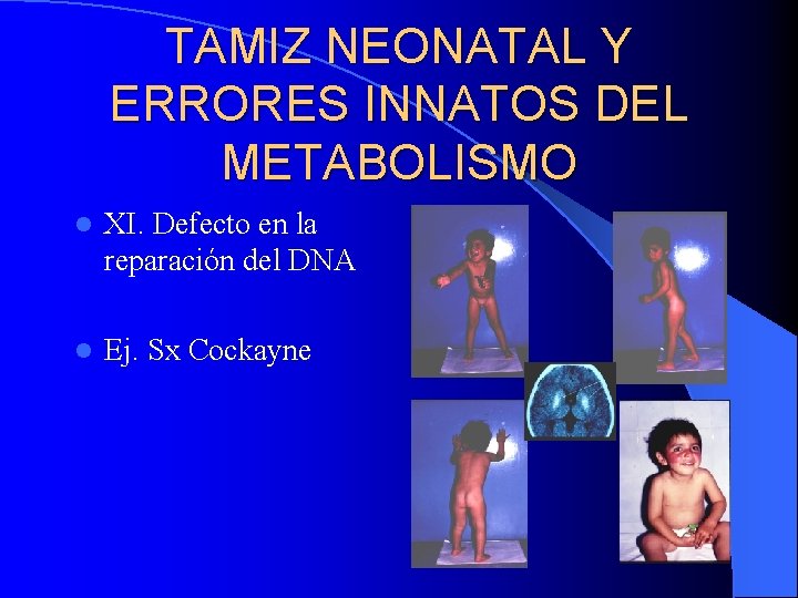 TAMIZ NEONATAL Y ERRORES INNATOS DEL METABOLISMO l XI. Defecto en la reparación del