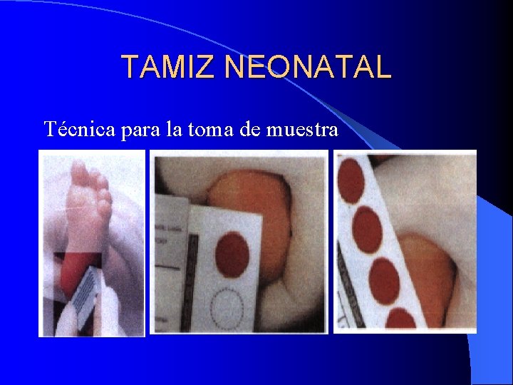 TAMIZ NEONATAL Y ERRORES INNATOS DEL METABOLISMO Dra