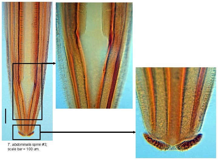 T. abdominalis spmn #3; scale bar = 100 um. 