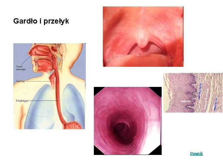 Gardło i przełyk Powrót Gardło i przełyk Powrót