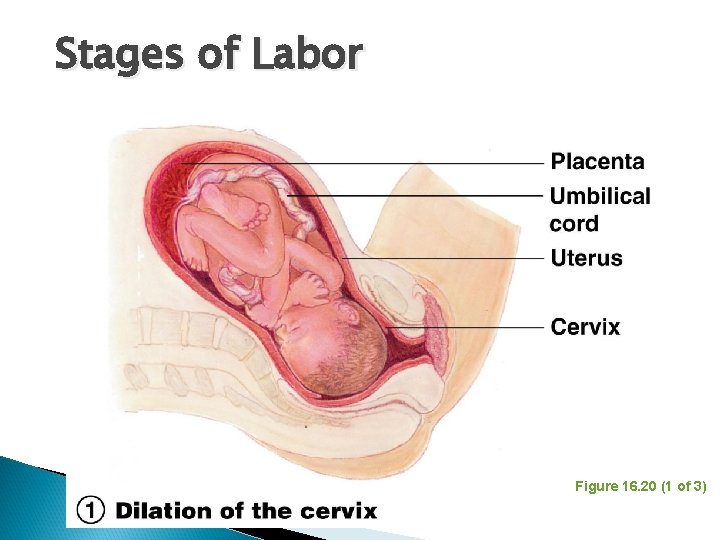 Stages of Labor Figure 16. 20 (1 of 3) 