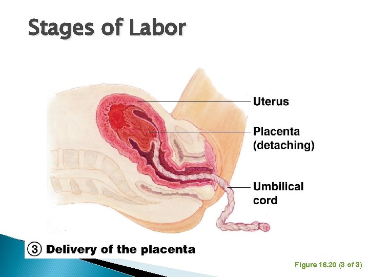 Stages of Labor Figure 16. 20 (3 of 3) 