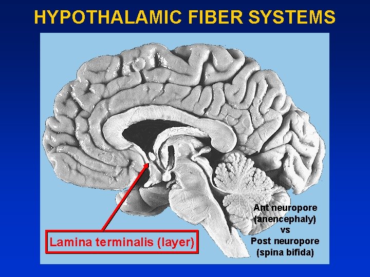 HYPOTHALAMIC FIBER SYSTEMS Lamina terminalis (layer) Ant neuropore (anencephaly) vs Post neuropore (spina bifida)