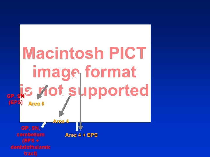 GP, SN (EPS) Area 6 Area 4 GP, SN, cerebellum (EPS + dentatothalamic tract)