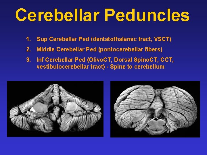 Cerebellar Peduncles 1. Sup Cerebellar Ped (dentatothalamic tract, VSCT) 2. Middle Cerebellar Ped (pontocerebellar