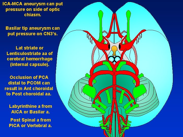 ICA-MCA aneurysm can put pressure on side of optic chiasm. Basilar tip aneurysm can